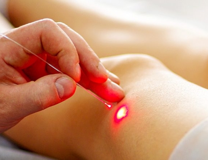 Крио- и лазерная терапии - Оздоровительные услуги - Санаторий «Боровое»